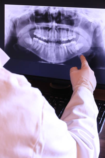 Best Emergency Treatment for Dental Infections or Abscesses in Hopelawn, NJ