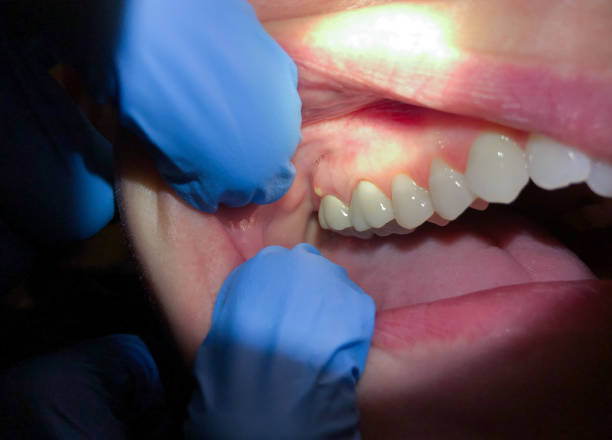 Best Pediatric Emergency Dentist in Hopelawn, NJ
